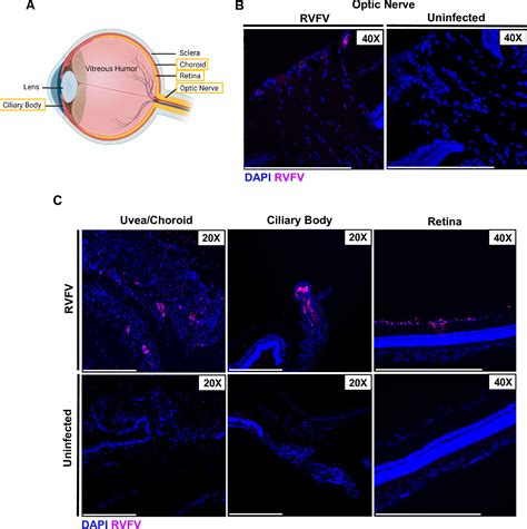 Rift Valley Fever Virus Infects The Posterior Segment Of The Eye And