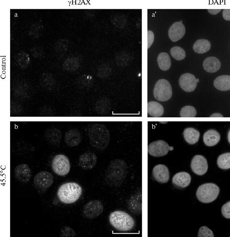 Figure From Shock Induced H Ax Foci Are Associated With The