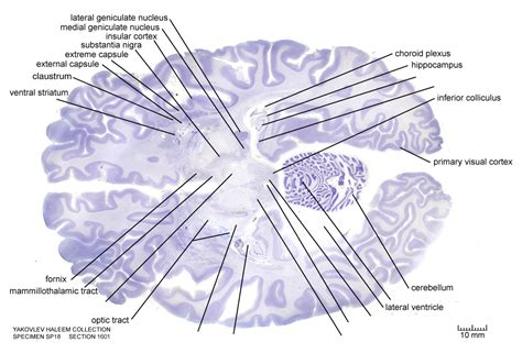 Horizontal Level As Cell Stain