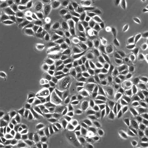 Human Skin Derived Epidermal Keratinocytes Neonatal