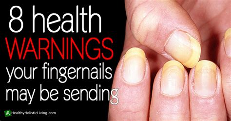 8 Health Warnings Your Fingernails May Be Sending Healthy Holistic