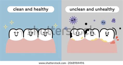 Illustration Set Clean Teeth Unclean Teeth Stock Vector Royalty Free