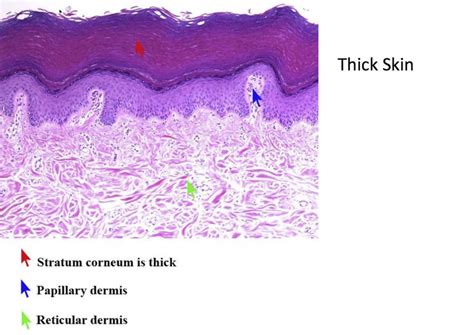 Thick Skin - Dermis and Epidermis - Histology | Thick skin, Dermis, Epidermis