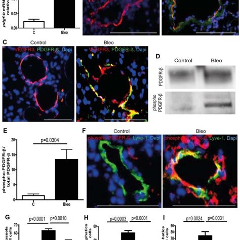 Aberrant Recruitment Of Mural Cells To Lymphatic Vessels During