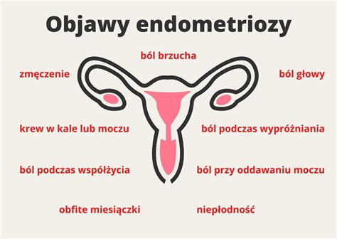 Endometrioza Objawy Jak Wyleczy Nietypowe Objawy