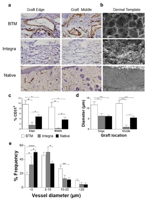 Detection Of Endothelial Cells In Mouse Grafts A Cd31 Positive
