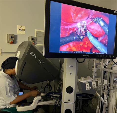 First Robotic Assisted Total Hysterectomy And Sacrocolpopexy At Groote