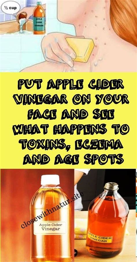 Put Apple Cider Vinegar On Your Face And See What Happens To Toxins Eczema And Age Spots It Has