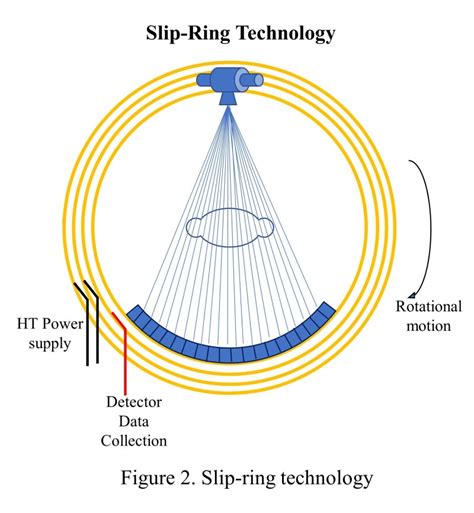 [figure Slip Ring Technology Contributed By Dibya Prakash Msc Physics Bioinformatics