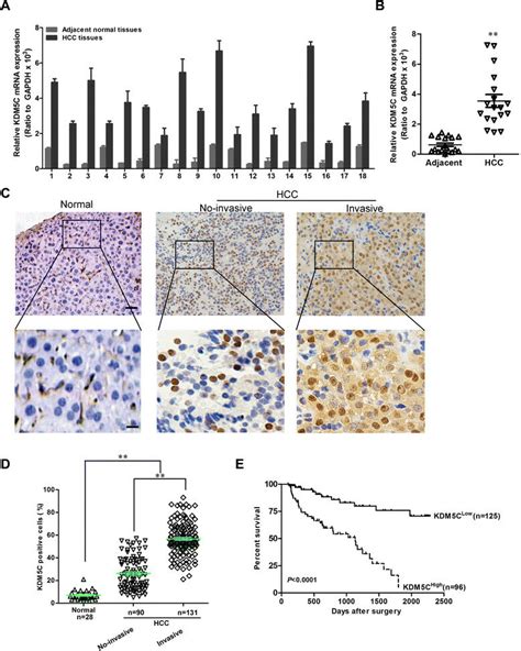 Kdm5c Is Highly Expressed In Hcc A Kdm5c Mrna Expression Was Analyzed