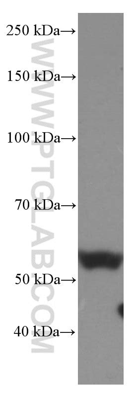 Occludin Fusion Protein Ag Proteintech