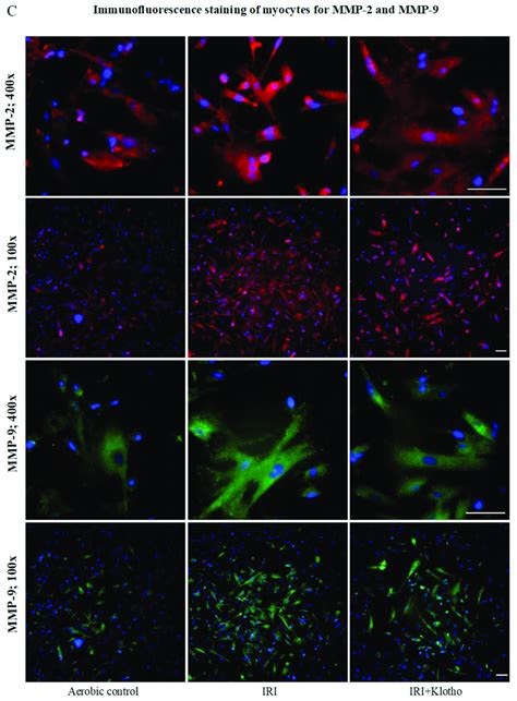 A Expression Of The Mmp Protein In Human Cardiomyocytes N Aerobic