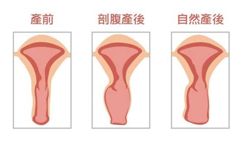 产后漏尿很尴尬，忽视这个更可怕 知乎