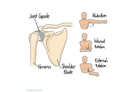 Symptoms Causes And Management Of Frozen Shoulder The Carlton Clinic