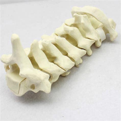 Buy Educational Model Life Size Human Cervical Vertebra Model Anatomy