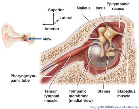 Tonic Tensor Tympani Syndrome Ttts Friends Against Wind