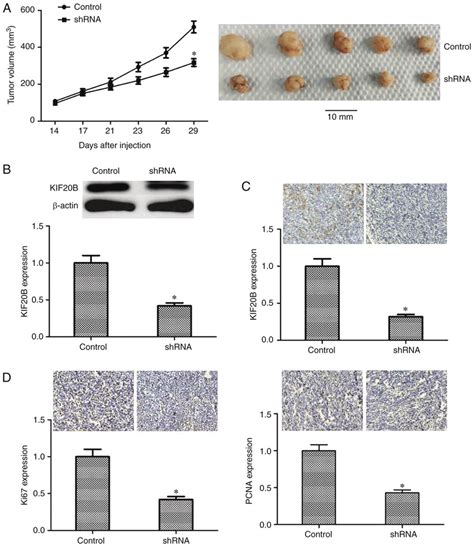 Kif B Knockdown Inhibits Tumor Growth In Vivo A Tumor Volume In