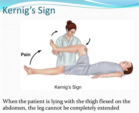 Kernig sign, Brudzinski sign, how to perform Kernig and Brudzinski test