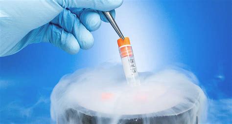 Egg Freezing/Fertility Preservation - Dr Rahul Veer