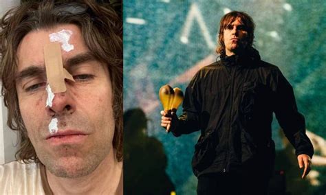 Oasis Singer Liam Gallagher Injured After Falling Out Of A Helicopter