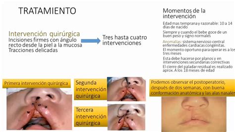 Patologias Del Recien Nacido Malformaciones Cong Nitas Youtube