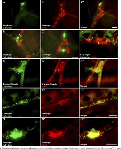 Figure 4 From Innervation Of Tracheal Parasympathetic Ganglia By