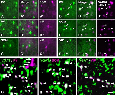 Chemical Characterization Of Three Distinct Subgroups Of Gabaergic