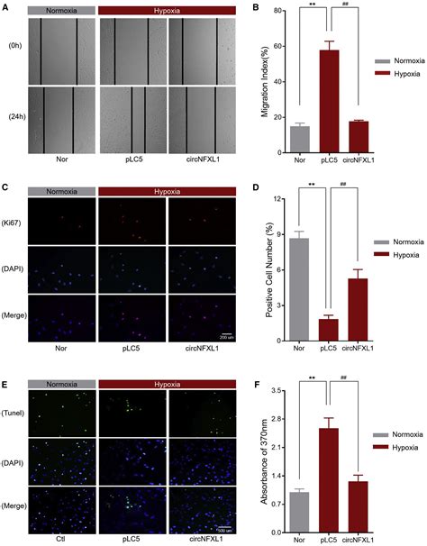 Hsacircnfxl1009 Modulates Apoptosis Proliferation Migration And