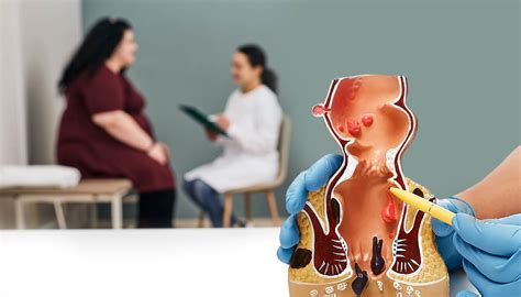 Anal Fissure Archives Dr Nivedita Pandey