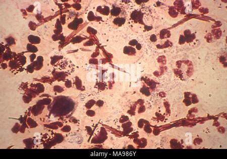 Neisseria Gonorrhoeae Bacteria Revelada En Las Bacterias Gram Negativas