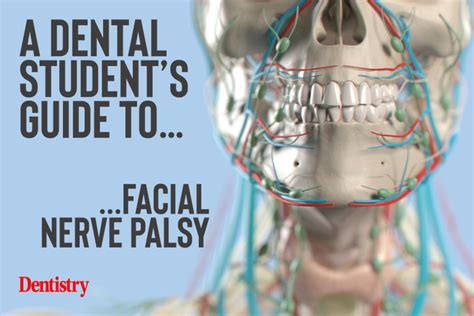 A Dental Student S Guide To Facial Nerve Palsy Dentistry