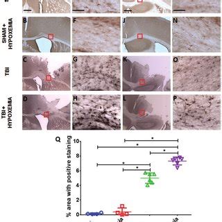 Immunohistochemical staining with the hypoxia marker pimonidazole ...