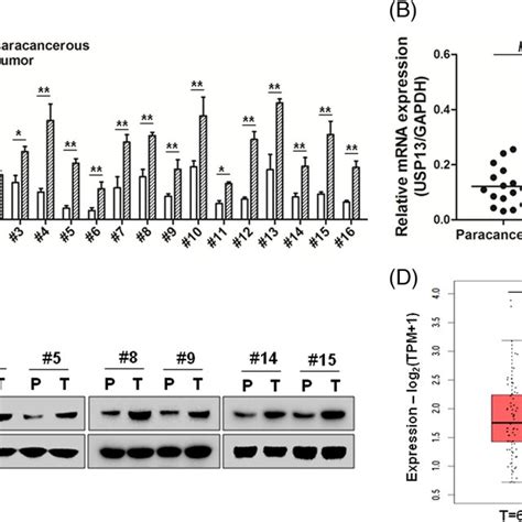 Knockdown Of Usp Inhibits Hcc Tumor Growth In Vivo A The Tumor