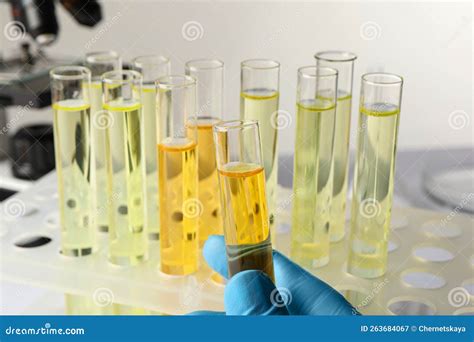 Nurse Holding Tube With Urine Sample For Analysis In Laboratory