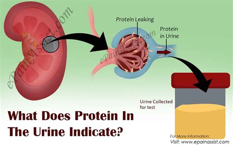 Does High Protein Diet Cause Kidney Problems - walldejnoronke.pages.dev