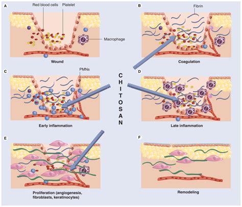 Chitosan Preparations For Wounds And Burns Antimicrobial And Wound