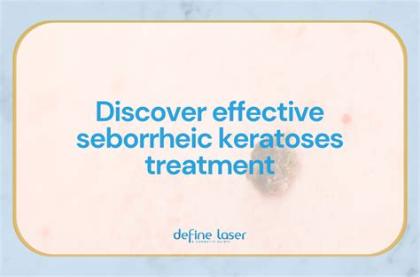 Discover Effective Seborrheic Keratoses Treatment At Define Laser