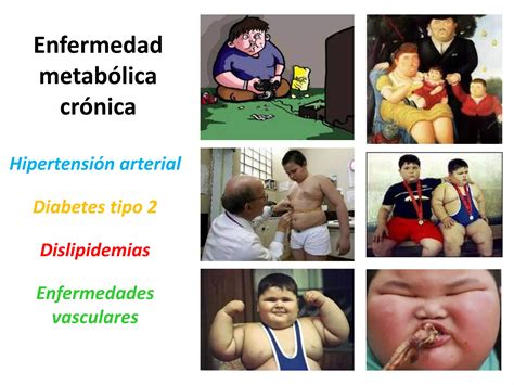 Obesidad Infantil Ppt