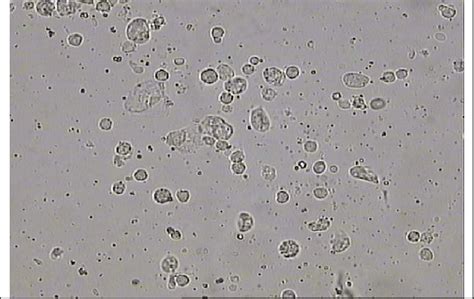 Wbcs In A Prepared Wet Stool Smear 40x Courtesy Of Dr Mohamed Hanafy Download Scientific