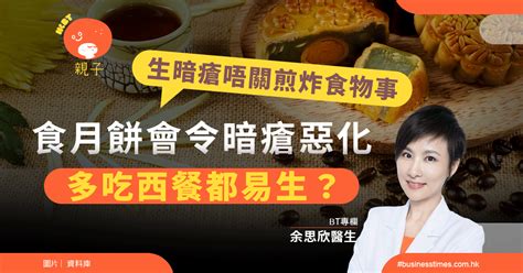 生暗瘡唔關煎炸食物事！食月餅會令暗瘡惡化、多吃西餐都易生？