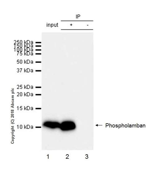 Anti Phospholamban 抗体 Epr21897 Bsa And Azide Free Ab234903