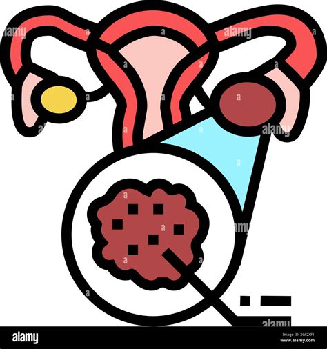 Polycystic Ovary Syndrome Endocrinology Color Icon Vector Illustration