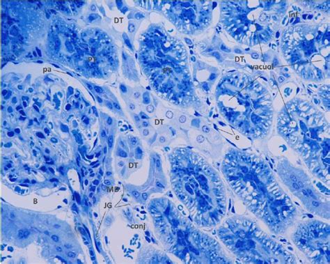 Malpighi Corpuscule In The Semislide Of Lornoxicam Group Proximal And