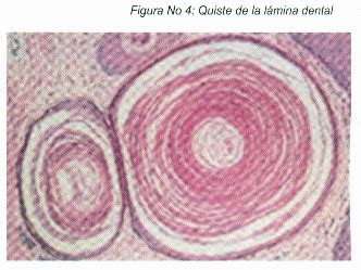 Archivos Bolivianos De Medicina Diagnostico Histopatologico De Las