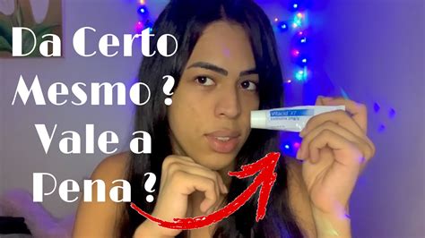 VITACID POMADA ÁCIDO DE FARMÁCIA MINHA EXPERIÊNCIA TRETINOÍNA 1mg