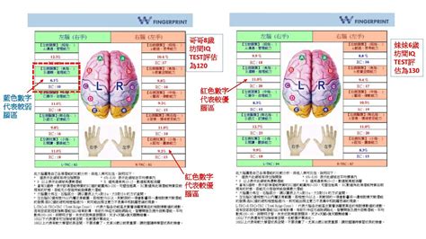 W Fingerprint 皮紋分析 9月 2018