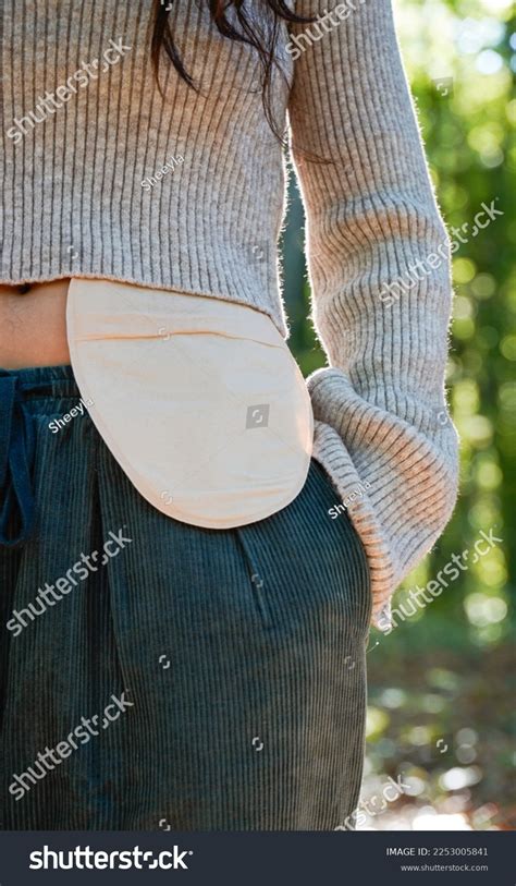 138 Person With Ostomy Images Stock Photos And Vectors Shutterstock