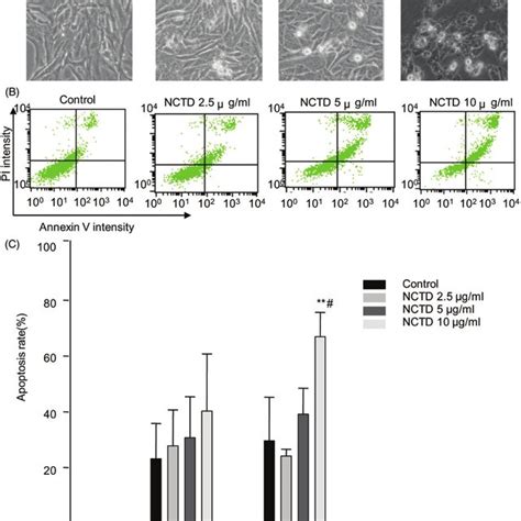 Effect Of NCTD On The Cell Cycle In HMC Cells Distribution Of Cell