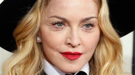 En Images Les Stars Avant Et Apr S La Chirurgie Esth Tique Madonna