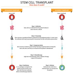 Understanding Stem Cell Transplant - Vanderbilt-Ingram Cancer Center